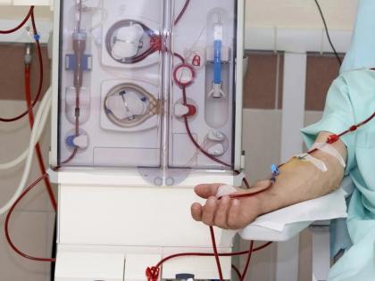 The primary test of corona binding before dialysis | डायलिसिस करण्यापूर्वी कोरोनाची प्राथमिक चाचणी बंधनकारक