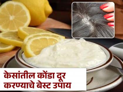 Use curd and lemon to removed Dandruff from hair | केसातील कोंडाही होईल दूर आणि केस होतील मजबूत, लगेच करा हे सोपे घरगुती उपाय