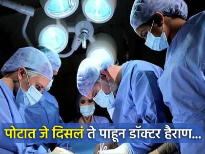 Doctors find living fly in man intestines during colonoscopy | कॅन्सरच्या चेकअपसाठी आलेल्या रूग्णाच्या पोटात दिसलं असं काही, बघून डॉक्टरही चक्रावले