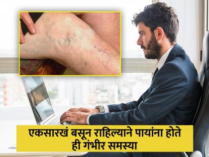 Sitting jobs can damage legs and cause varicose veins know how to make legs strong | सतत बसून काम केल्याने पायांना होईल ही गंभीर समस्या, डॉक्टरांनी सांगितले उपाय