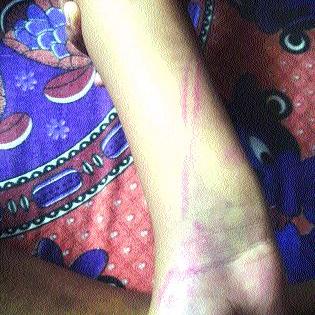 A nine-year-old girl was beaten up by a non-study | अभ्यास न केल्याने शिक्षिकेची नऊ वर्षांच्या मुलीला मारहाण A nine-year-old girl was beaten up by a non-study | अभ्यास न केल्याने शिक्षिकेची नऊ वर्षांच्या मुलीला मारहाण