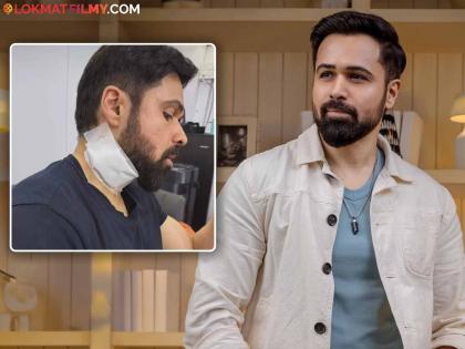 Emraan Hashmi was injured during the shooting, fans were shocked to see the wound on his neck | शूटिंगदरम्यान Emraan Hashmiला झाली दुखापत, मानेला झालेली जखम पाहून चाहते झाले हैराण