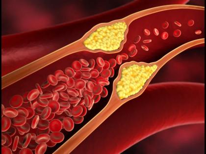 Consume fiber rich foods to prevent bad cholesterol and heart attack know how to lower ldl cholesterol | कोलेस्ट्रॉल हृदयापर्यंत पोहोचलं तर येतो हार्ट अटॅक, नसांमधून ते बाहेर करण्यासाठी काय करावं?