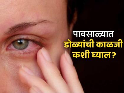 eye care tips during monsoon know some essential tips by expert solution for itchy eyes and infection | डोळ्यांची जळजळ तसेच सतत खाज सुटते? पावसाळ्यात अशी घ्या काळजी; तज्ज्ञांनी सांगितले उपाय