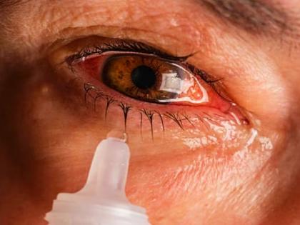 Two and a half lakh people got 'eyes virus infected in the state; Buldhana number one, Mumbai still safe | राज्यात अडीच लाख लोकांना आले ‘डोळे’; बुलढाणा नंबर एक, मुंबई अजूनही सेफ