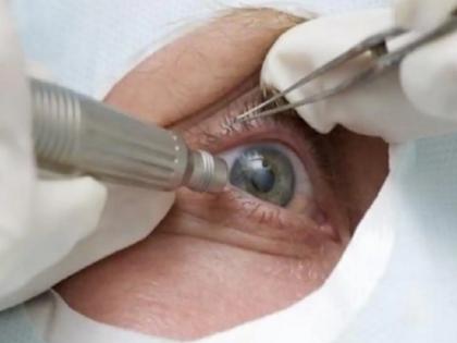 cataract surgery stopped dur to Corona; Hundreds of patients at risk of glaucoma | मोतीबिंदू शस्त्रकियेला 'कोरोना'ची लागण; शेकडो रुग्णांना काचबिंदू होण्याचा धोका