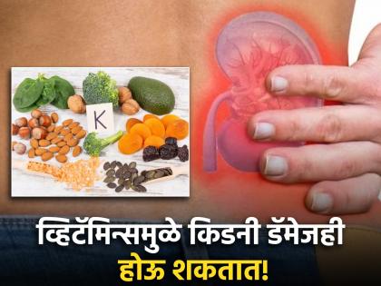 These vitamins to avoid in kidney disease which can decrease kidney size and function | व्हिटॅमिन्सचे फायदे माहीत असतीलच आता किडनीला होणारे नुकसानही जाणून घ्या!