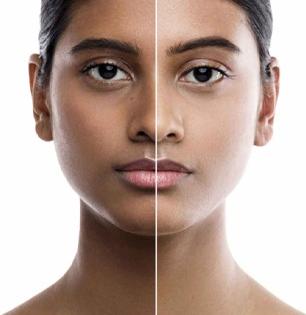 मसूर डाळीचा ‘हा’ व्हायल फेसपॅक लावा, दिवाळीत दिव्यासारखा चमकेल तुमचाही चेहरा