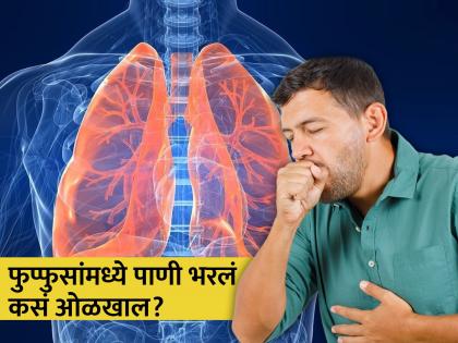 Water in lungs or pulmonary edema causes, symptoms, treatment and home remedies | खोकला ते श्वासनास त्रास ही आहेत फुप्फुसांमध्ये पाणी भरल्याची लक्षणं, दुर्लक्ष कराल तर...