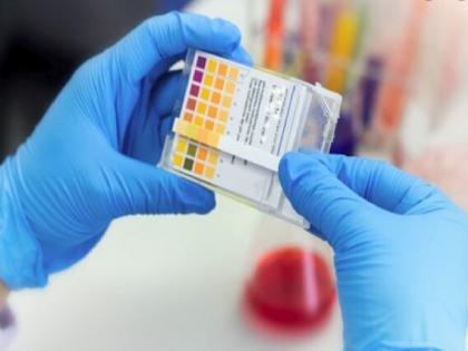 FELUDA टेस्ट क्या है ? जो मिनटों में बता देता है कोरोना रिपोर्ट, RTPCR से कितना बेहतर ?