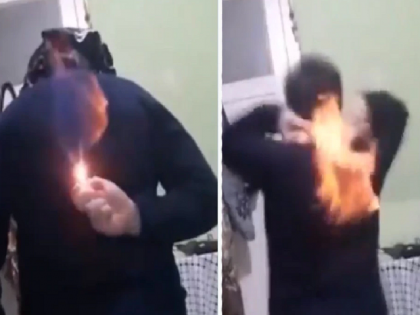 Shocking Video: youth set his back on fire to make social media reels; Watch video | Shocking Video: बोंबला! रिल्स बनवण्याच्या नादात स्वतःच्या पाठीला लावली आग; पाहा Video