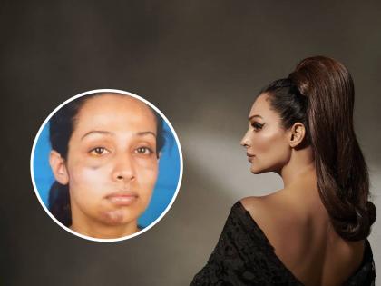 Almost killed by her ex- boyfriend, shocking revelation of Gandii Baat actress Flora Saini after Shraddha murder case