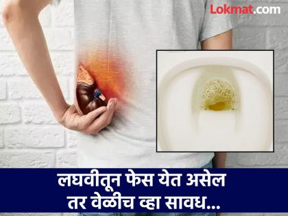 Foamy urine causes and symptoms, Ayurvedic treatment for foamy urine | तुमच्याही लघवीमधून फेस येतो का? जाणून घ्या कारणं आणि आयुर्वेदिक उपाय...