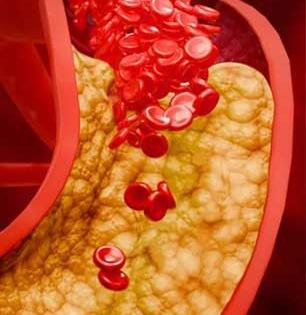 कोलेस्टेरॉल कमी करणारे रोजच्या आहारातलेच ७ पदार्थ, महिन्याभरात दिसेल फरक - टळेल धोका...