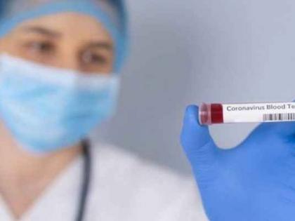 CoronaVirus: Patients are ‘corona’ free; But alarm bells forever! | CoronaVirus : रुग्ण ‘कोरोना’मुक्त होताहेत; पण धोक्याची घंटा कायमच!