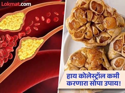 Fried garlic to control bad cholesterol, know how to consume it | नसांमध्ये जमा झालेलं बॅड कोलेस्ट्रॉल दूर करेल भाजलेला लसूण, वाचा कसं कराल सेवन!