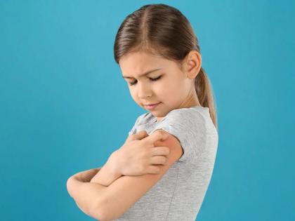 Risk of fungal infection during monsoon, take special care of young children | Monsoon: पावसाळ्यात फंगल इन्फेक्शनचा धोका, लहान मुलांची विशेष काळजी घ्या! डॉक्टरांचा सल्ला Risk of fungal infection during monsoon, take special care of young children | Monsoon: पावसाळ्यात फंगल इन्फेक्शनचा धोका, लहान मुलांची विशेष काळजी घ्या! डॉक्टरांचा सल्ला