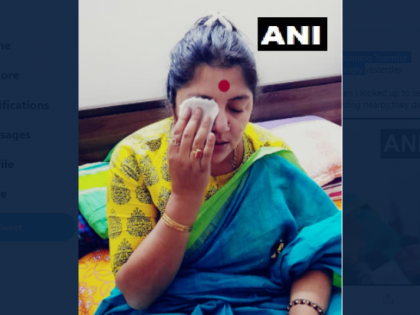 BJP's Locket Chatterjee alleges that colours containing 'harmful chemicals' was thrown on her face | भाजपाच्या महिला उमेदवारावर फेकला विषारी रंग; प्रकृती चिंताजनक, TMC वर केला गंभीर आरोप