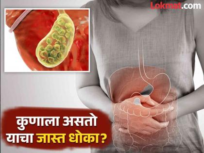 Which foods cause gallbladder stone, you should know | घशातून आत जाताच पित्ताशयात स्टोन बनतात 'हे' पदार्थ, रोज खाणं पडू शकतं महागात!