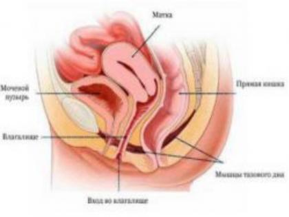 Third consecutive surgery in the country of uterine transplant successfully succeeded in Pune | गर्भाशय प्रत्यारोपणाची देशातील सलग तिसरी शस्त्रक्रिया पुण्यात यशस्वी