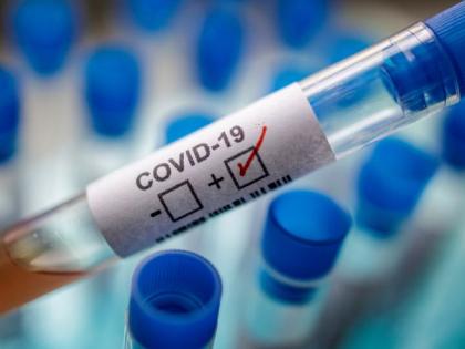 A young woman from Mumbai in Wardha district tested positive for corona | Corona Virus in Wardha; वर्धा जिल्ह्यात मुंबईहून आलेली तरूणी निघाली कोरोना पॉझिटिव्ह