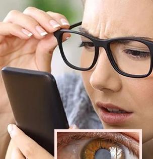 डोळ्यांसाठी 'सायलेंट किलर' ठरतो ग्लुकोमा, पाहा लक्षणं- काचबिंदूचा अनुवंशिक त्रासही दृष्टीसाठी घातक