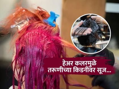 सतत हेअर कलर केल्यानं तरुणीला झाला किडनीचा गंभीर आजार, पाहा केसांचा रंग कसा ठरला घातक.. - Marathi News | 20 Years Old Woman Gets Kidney Disease After Dyeing Hair Monthly To Match Pop Idol | Latest sakhi News at Lokmat.com