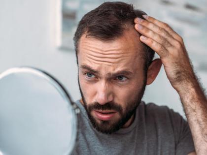 hair fall in men causes and remedies | Hair loss in Men: तरुण वयातच टक्कल पडायला सुरुवात होते, पुरुषांच्या केसगळतीची आहेत ही चिंताजनक कारणं