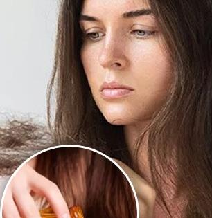 खोबऱ्याचं, मोहरीचं की आवळ्याचं तेल - कोणत्या तेलानं केसगळती थांबते? डर्मेटोलॉजिस्टनी स्पष्टच सांगितलं....