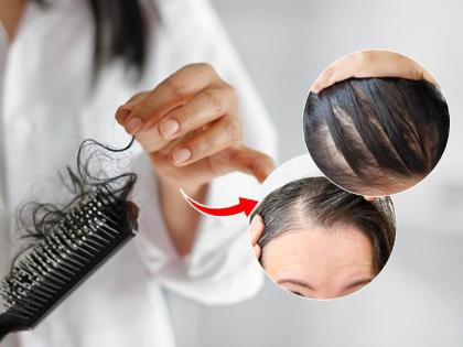 Why does hair fall more in winter know about how to control hair fall here some tipsa for you | हिवाळ्यात केस अधिक का गळतात? हेअर फॉल थांबवण्यासाठी करा हे उपाय