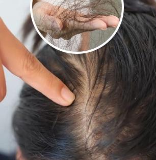 हिवाळ्यात केस खराट्यासारखे रखरखीत होऊन गळत असतील तर लावा ३ तेल, थंडीत तुमचे केस होतील रेशमी...