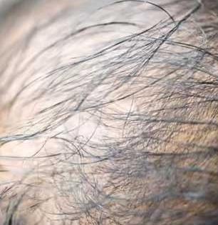 केस सतत गळतात, तुटतात- फाटेही फुटले? चहा पावडरमध्ये मिसळा १ गोष्टी, डॅमेज केस होतील सुंदर- घनदाट