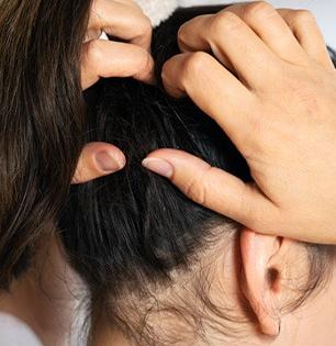 पावसाळ्यात डोक्याला खाज सुटते, उवा-लिखा झाल्या? ५ सोपे उपाय - केसांच्या समस्या होतील दूर