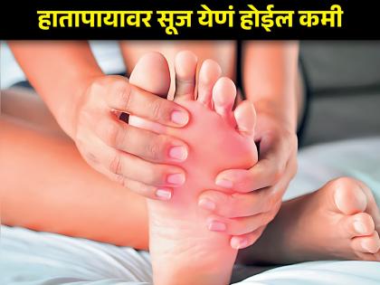 Health tips how do you get rid of swallen hands and feet in winter read about this | थंडीत हातापायाची बोटं सुजतात? मग आजच करा 'हे' उपाय; त्वरित जाणवेल फरक