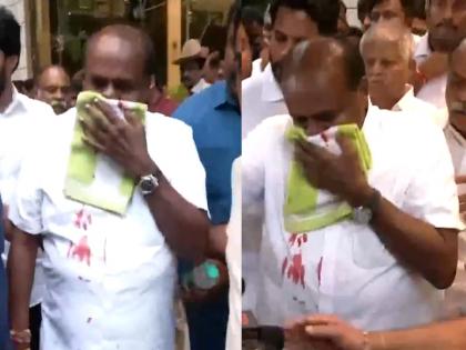 HD Kumaraswamy's nose bleeds during press conference; admitted to hospital | Video: पत्रकार परिषदेत एचडी कुमारस्वामींच्या नाकातून रक्ताची धार; रुग्णालयात दाखल