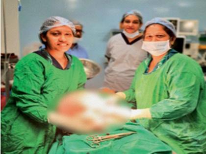 A 10 kg water ball was removed from the woman's stomach | महिलेच्या पोटातून काढला १० किलोंचा पाण्याचा गोळा