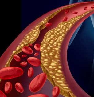 कोलेस्टेरॉल वाढलेलं पोखरलेलं शरीर रोज जातं मृत्यूच्या जवळ..! ५ गोष्टी रोज करा, जगण्याची क्वालिटी सुधारेल