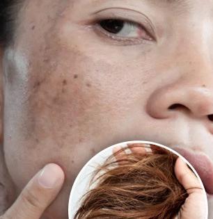 त्वचा आणि केसांचा बदलता रंग-पोत सांगतो गंभीर आजाराचा धोका, डॉक्टर सांगतात अचानक बदल दिसला तर..