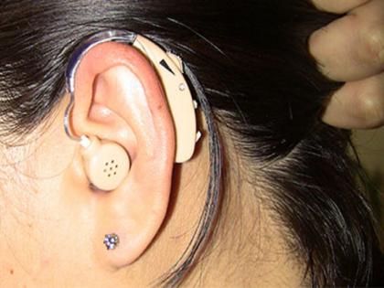 Companies are reluctant to supply hearing aids due to reduction in government rates | कर्णबधिरांची होतेय फरफट; शासकीय दर घटविल्याने श्रवणयंत्र पुरवठ्यास कंपन्या धजावेनात