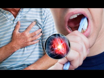 Teeth and gum inflammation could be the early sign of heart attack know important health tips after 45 age | हार्ट अटॅकच्या अनेक महिन्यांआधी दातांमध्ये होतो असा बदल, डॉक्टरांच्या या सल्ल्यांकडे करू नका दुर्लक्ष