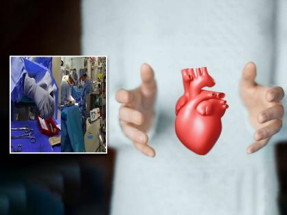 Miracle Asia first bloodless heart transplant successfully performed in Marengo CIMS Hospital Ahmedabad India | चमत्कार!! देशात प्रथमच रुग्णाला रक्त न चढवता हृदय प्रत्यारोपण, 'या' शहरात यशस्वी शस्त्रक्रिया