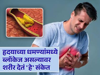 Signs in the body indicate blockage in arteries | हृदयाच्या रक्तवाहिन्या ब्लॉक झाल्यावर दिसतात 'ही' लक्षण, दुर्लक्ष करणं पडू शकतं महागात