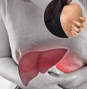 World Hepatitis Day 2025: ‘या’ घातक सवयींमुळे वाढतंय हिपॅटायटीसचं प्रमाण, पाहा धोके आणि उपाय