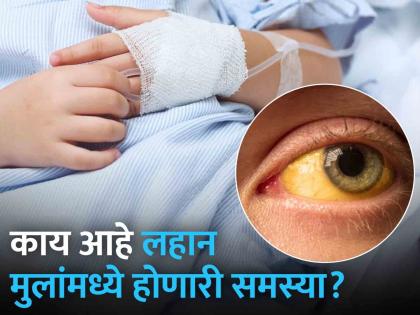 Long-term effects of hepatitis on children | हेपेटायटिसचा लहान मुलांवर होणारा दीर्घकालीन परिणाम