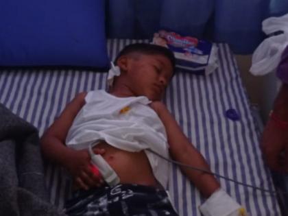 बिबट्याच्या हल्ल्यात जखमी झालेला चिमुकला बिबट्याच्या हल्ल्यात जखमी झालेला चिमुकला