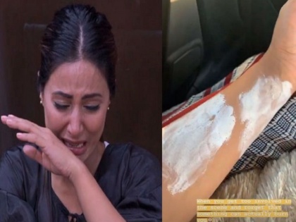 Hina Khan injured in 'Kasati Zindagi ki 2' set | 'कसौटी जिंदगी की 2'च्या सेटवर हिना खान जखमी
