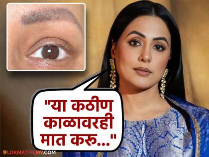 hindi television actress hina khan last chemotherapy left single eyelash on her eyes | केमोथेरपीमुळे हिना खानच्या पापण्यांवरील केसही झाले विरळ; फोटो शेअर करत दिली हेल्थ अपडेट