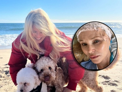 americal actress Christie Brinkley undergoes surgery after diagnosed with skin cancer shared post | प्रसिद्ध अभिनेत्रीला स्किन कॅन्सरचं निदान, सर्जरीनंतर शेअर केला हॉस्पिटलमधील फोटो