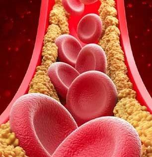 दह्यामध्ये 'हा' पांढरा पदार्थ मिसळून खा, वाढलेलं कोलेस्टेरॉल आणि ट्रायग्लिसराईड पटापट होईल कमी