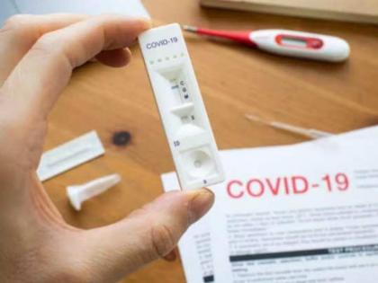 rising demand for Home Testing Kits If it is hidden the support will increase three times doctor warning | Corona Test: होम टेस्टिंग किटच्या मागणीत वाढ; लपवालपवी केल्यास साथ तिपटीने वाढणार, डॉक्टरांचा इशारा